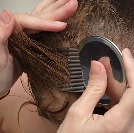 De nat-kam-methode is dé manier om luizen te bestrijden